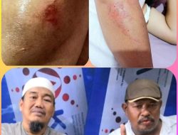 Peduli Sahabat, Ketua LSM WGAB Papua Turut Prihatin Atas Lakalantas Yang Dialami Bos Pasar Malam Anto