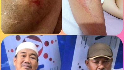 Peduli Sahabat, Ketua LSM WGAB Papua Turut Prihatin Atas Lakalantas Yang Dialami Bos Pasar Malam Anto